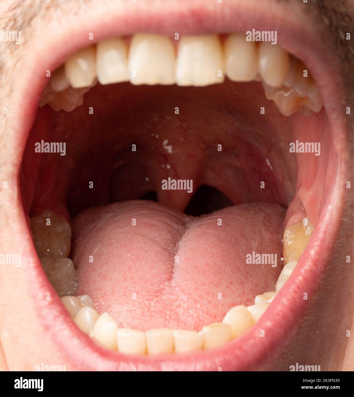 Lengüeta en vista de primer plano de boca de hombre abierta Foto de stock