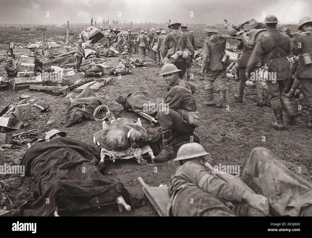 Hombres heridos en la batalla de Ypres del 20th de septiembre de 1917. Caminando por el camino de Menin, para ser llevado a la estación de despeje durante la Batalla de Ypres. Se ve a prisioneros alemanes asistiendo en la camilla. Foto de stock