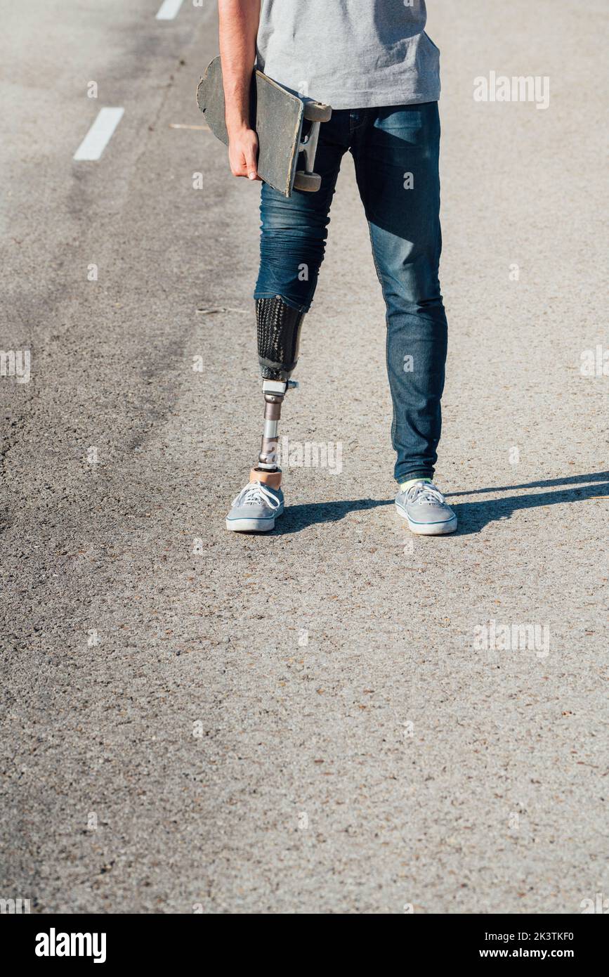 Hombre joven con prótesis de pierna de pie mientras sostiene el monopatín contra un edificio de concreto en la calle Foto de stock