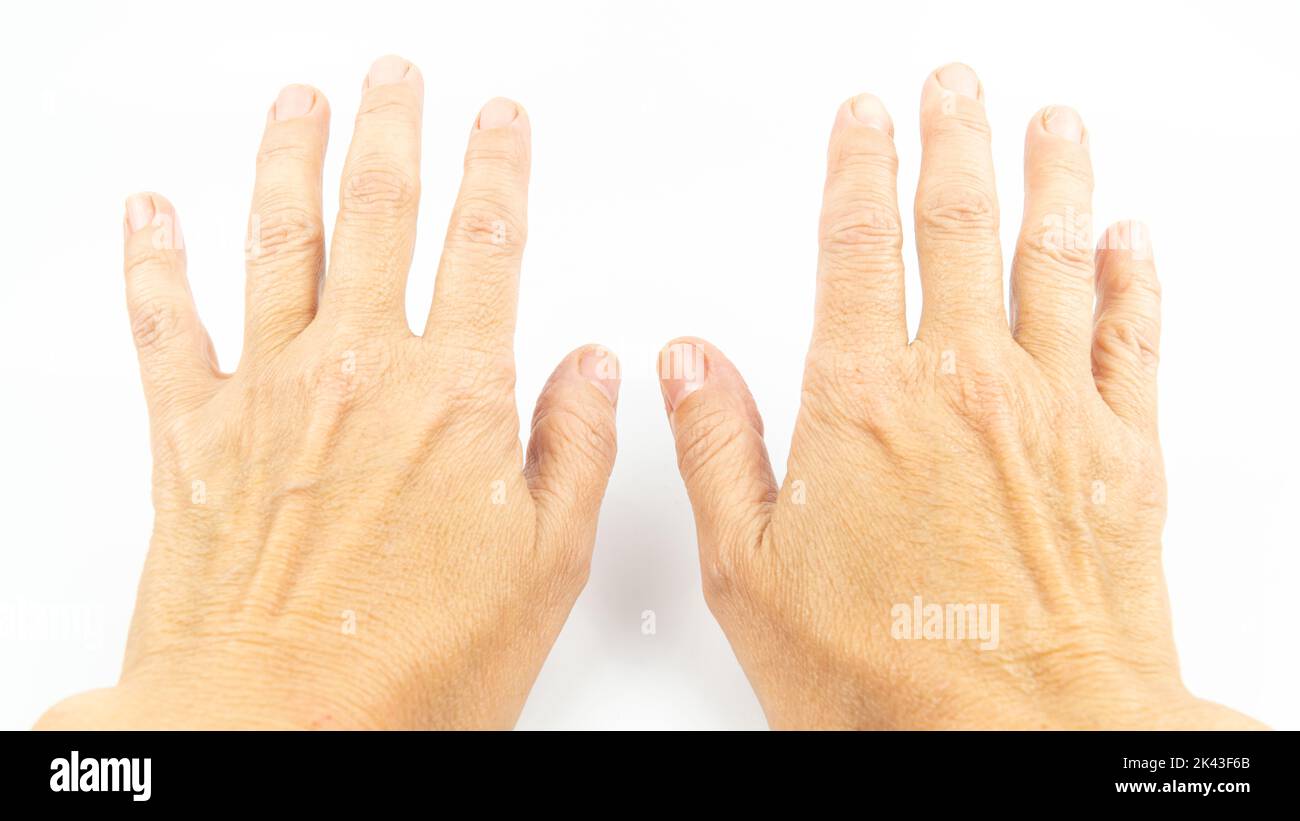 Manos de una mujer de mediana edad sobre el fondo blanco. Arrugas en la mano de la mujer. Concepto de cuidado de la piel Foto de stock