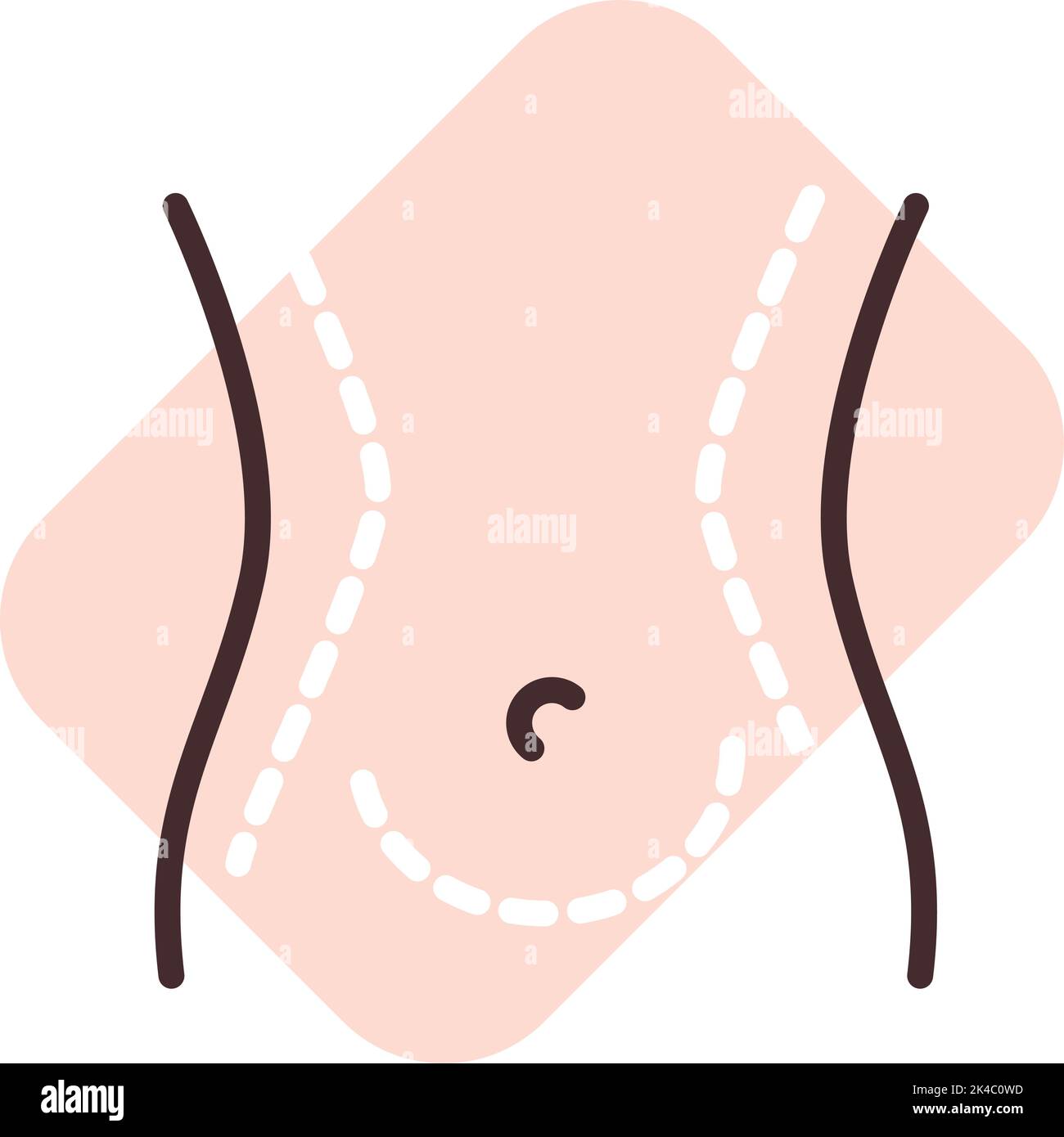 Cirugía de liposucción, ilustración, vector sobre fondo blanco Imagen