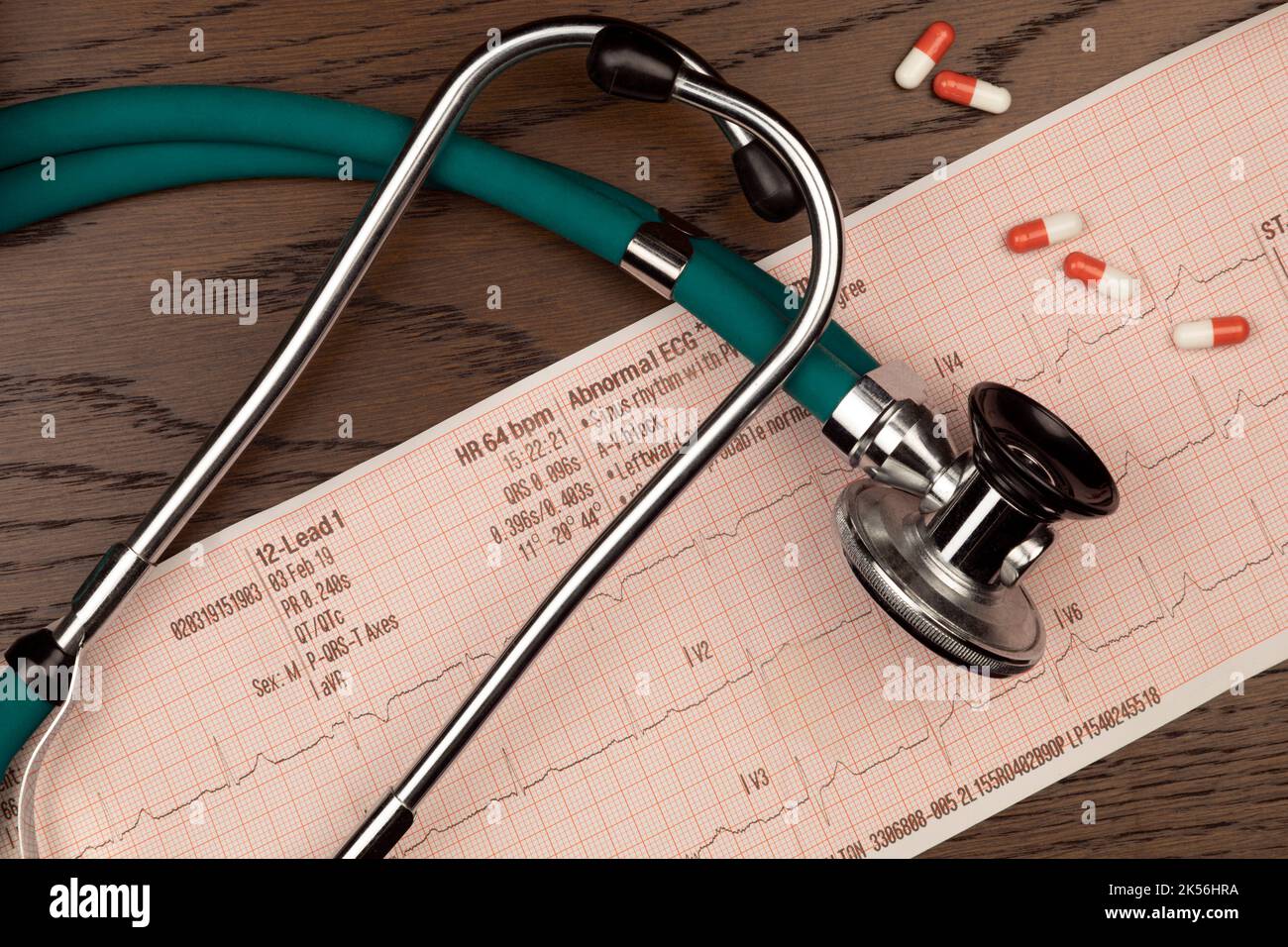 Tratamiento médico - los médicos estetoscopio y una traza de ECG. Foto de stock