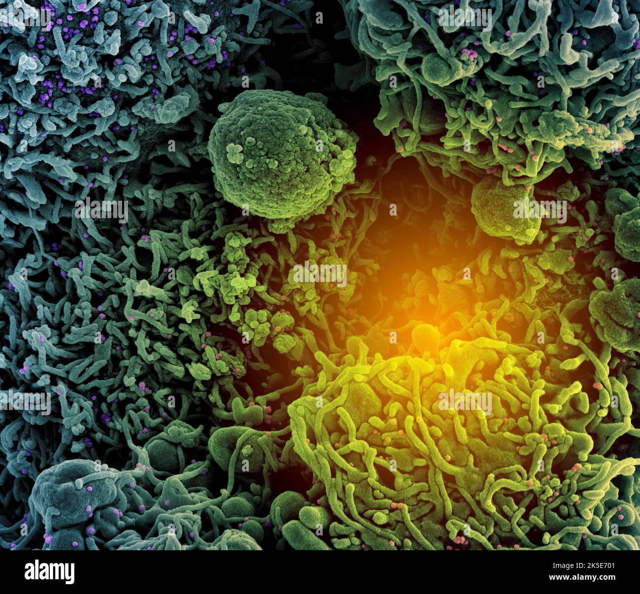 Nuevo coronavirus SRAS-CoV-2. Micrografía electrónica coloreada de una célula (verde azulado) infectada con una cepa variante de partículas del virus del SARS-CoV-2 (UK B.1.1.7- púrpura y rosa), aislada de una muestra de paciente. Imagen capturada en la Instalación Integrada de Investigación (IRF) de NIAID en Fort Detrick, Maryland. Una versión compuesta única optimizada y mejorada de seis imágenes micrográficas electrónicas de barrido, crédito: NIAID Foto de stock