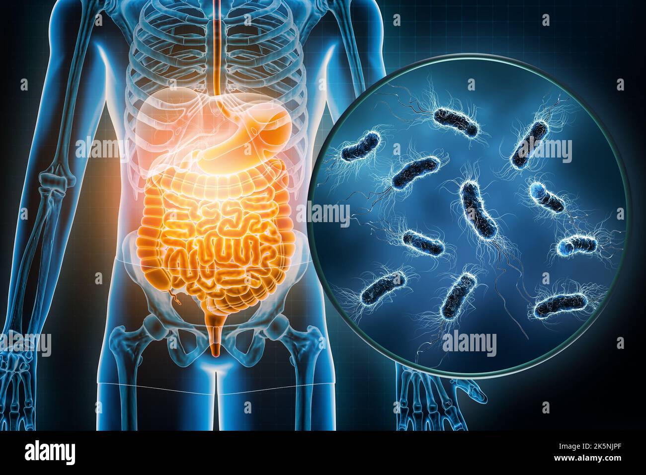 Infección bacteriana del tracto gastrointestinal 3D ilustración. Escherichia coli o E. coli enfermedad infecciosa, anatomía, médica, biología Foto de stock