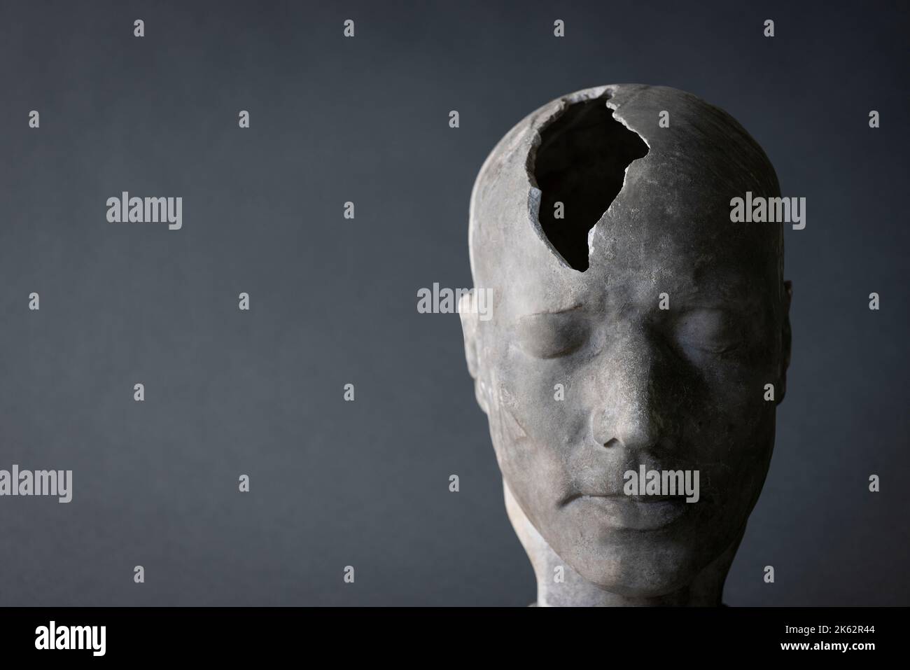 Concepto de Salud Mental Mostrando Modelo de Cabeza con Pieza Fracturada en Cráneo Foto de stock