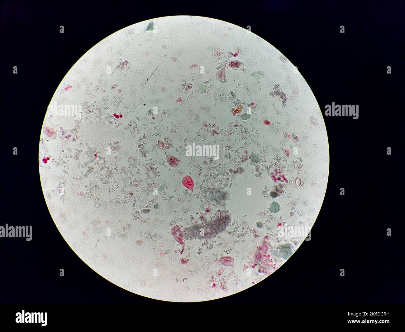 Giardia lamblia microscopio fotografías e imágenes de alta resolución -  Alamy