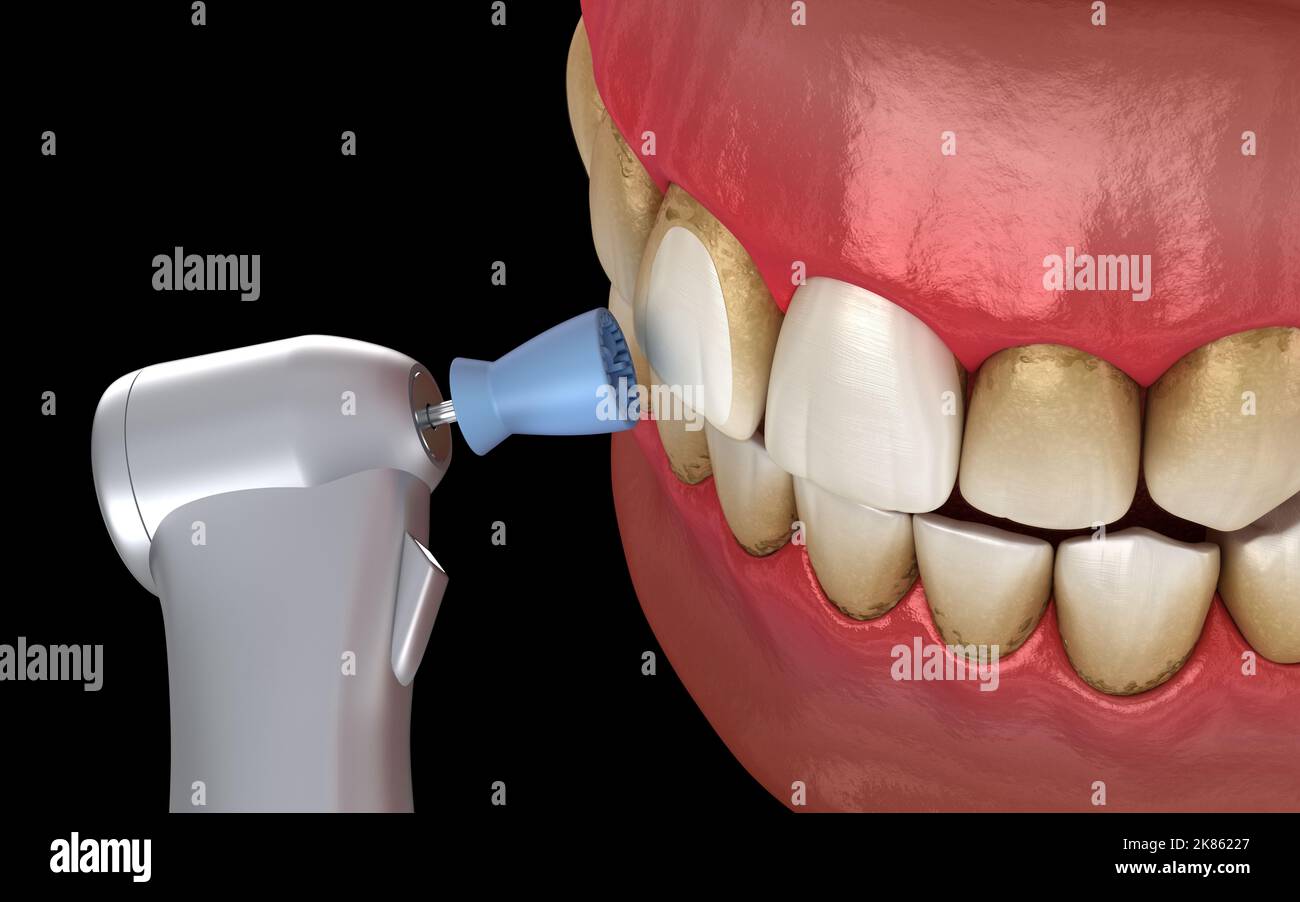 Pulido de dientes fotografías e imágenes de alta resolución - Alamy