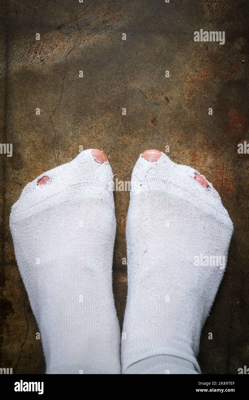 Hombre dedos de los pies a través de agujeros en calcetines blancos, concepto de dificultad Foto de stock