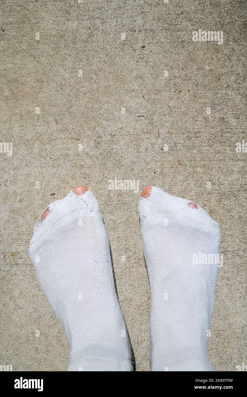 Hombre dedos de los pies a través de agujeros en calcetines blancos, concepto de dificultad Foto de stock