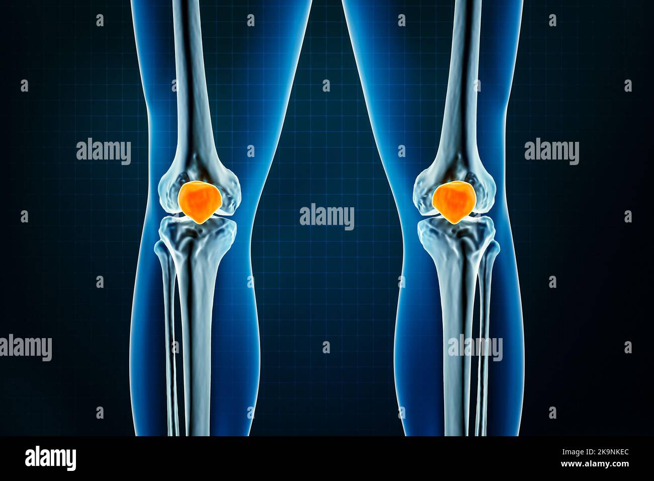Huesos Del Cuerpo Humano Vista Posterior Republicret - vrogue.co