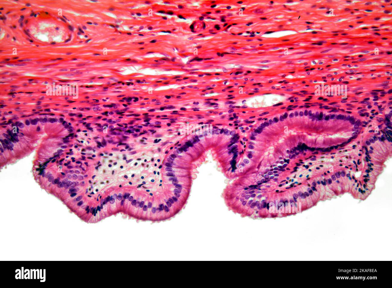 La vesícula biliar humana sección brightfield microfotografía Foto de stock