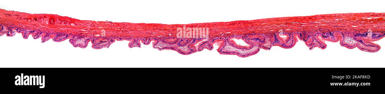 La vesícula biliar humana sección brightfield microfotografía Foto de stock