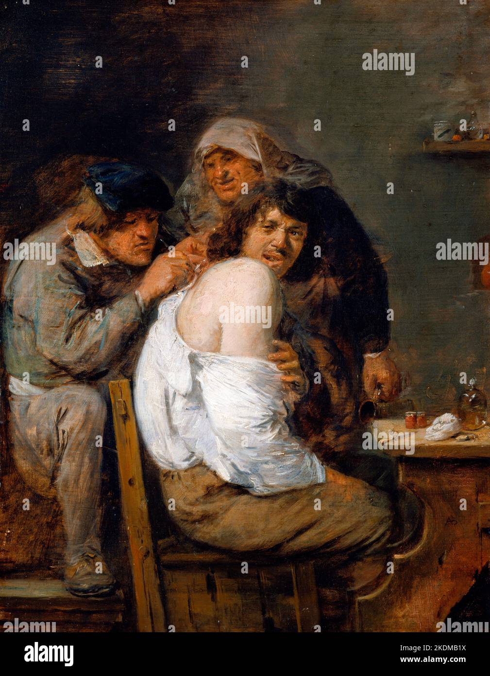 La Operación de Regreso por el artista barroco flamenco Adriaen Brouwer (c. 1605-1638), aceite sobre panel, c. 1636 Foto de stock