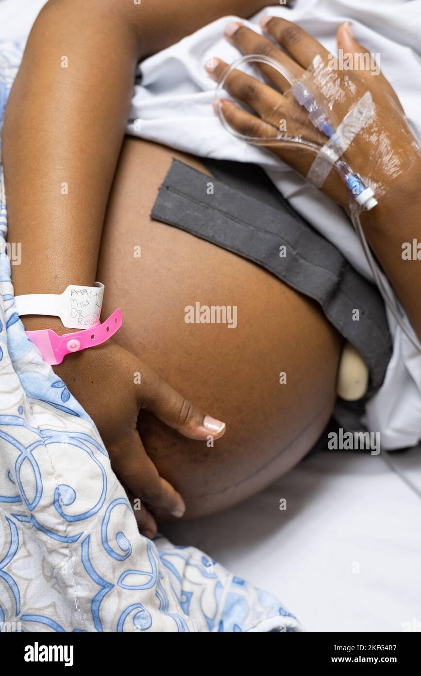 Una mujer embarazada en el trabajo de parto, acostada en una cama de hospital esperando a que nazca su bebé. Foto de stock
