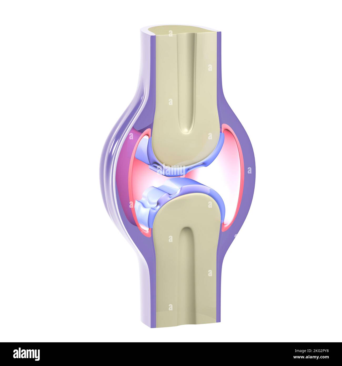 3D ilustración de una articulación sinovial con artrosis. Representación gráfica de huesos, tendones y cartílagos sobre fondo blanco. Foto de stock