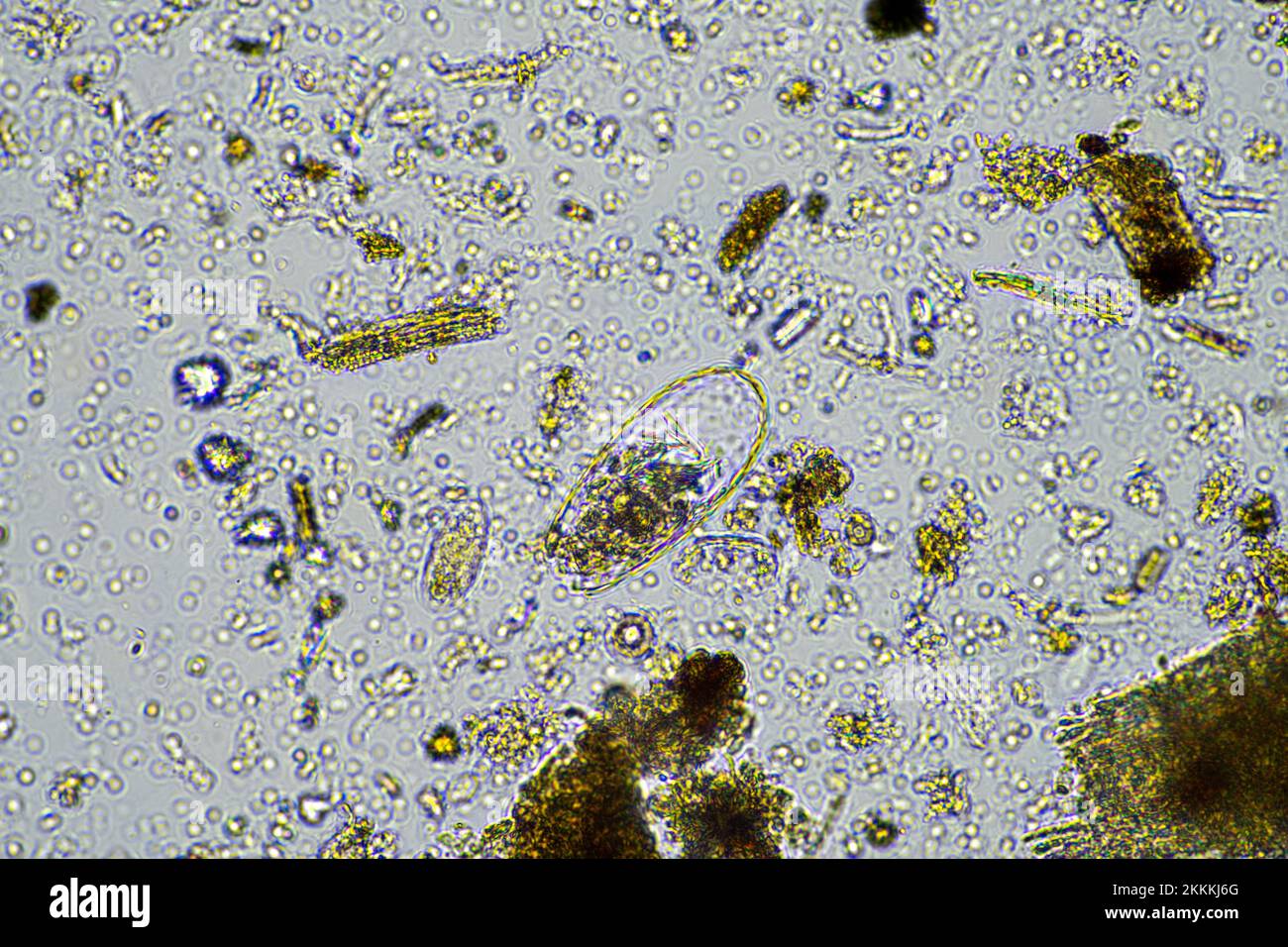 hongos y microorganismos del suelo en una muestra de suelo y abono en primavera Foto de stock