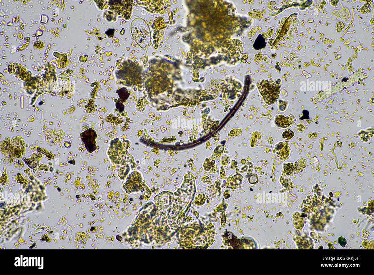 hongos y microorganismos del suelo en una muestra de suelo y abono en primavera Foto de stock
