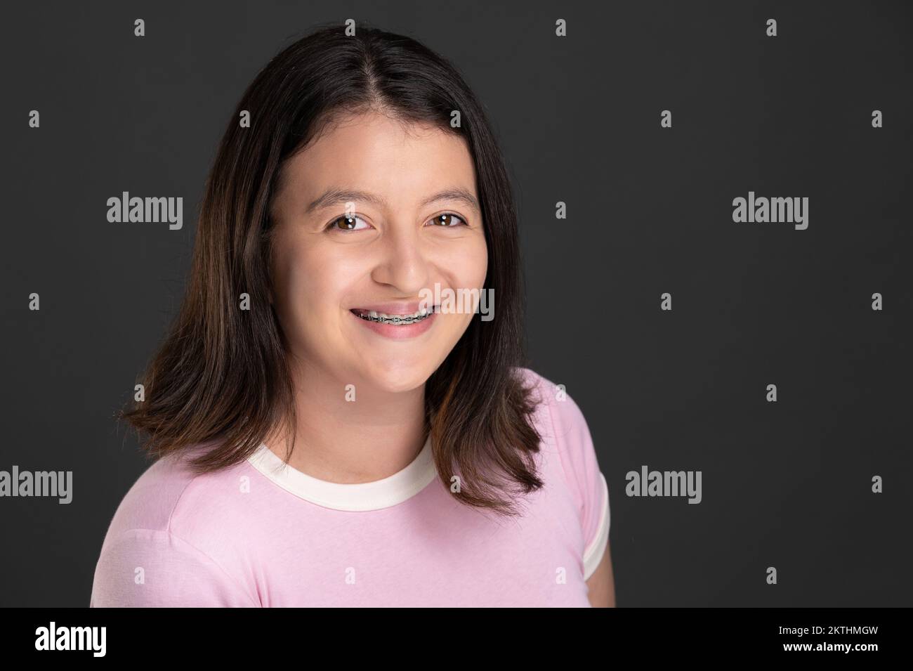 Imagen de la joven sonriente con los dientes soportes aislados sobre el fondo del estudio Foto de stock