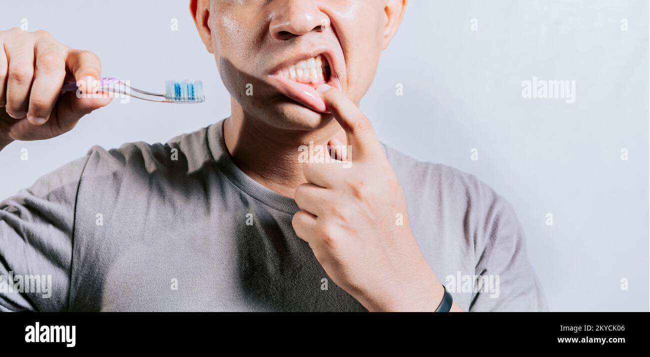 Persona con gingivitis sosteniendo el cepillo dental. Personas que  sostienen el cepillo de dientes con dolor en las encías. Hombre sosteniendo  el cepillo de dientes con dolor en las encías, gente sosteniendo