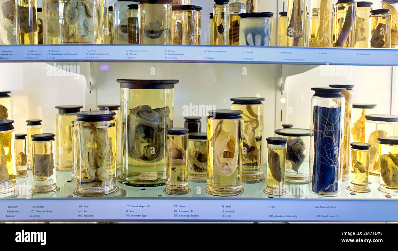 LA OOLLECCIÓN DE MEDICINA Y ANATOMÍA HUNTERIA, una selección de partes del cuerpo conservadas en formaldiodo en frascos Foto de stock