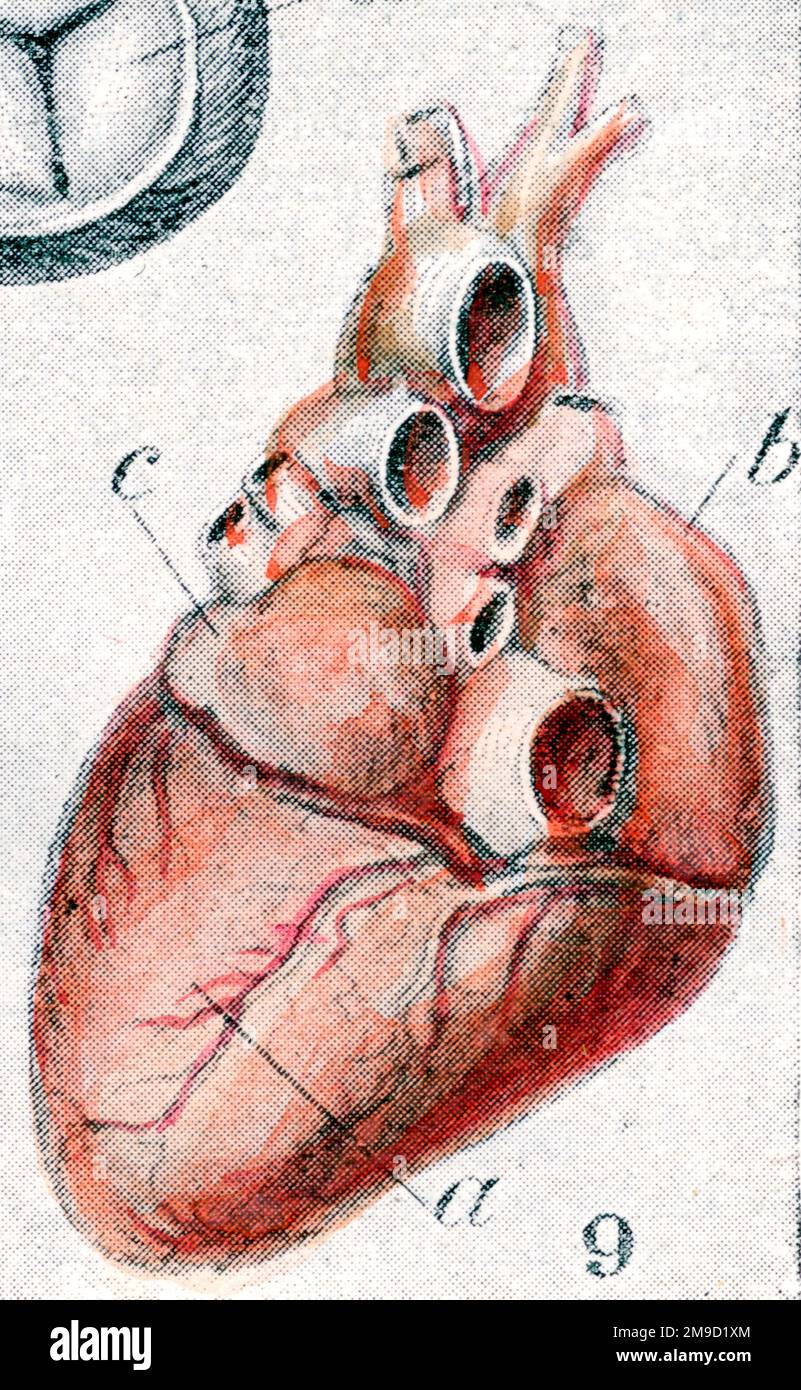 Corazón humano - Hombre Cutaway Foto de stock