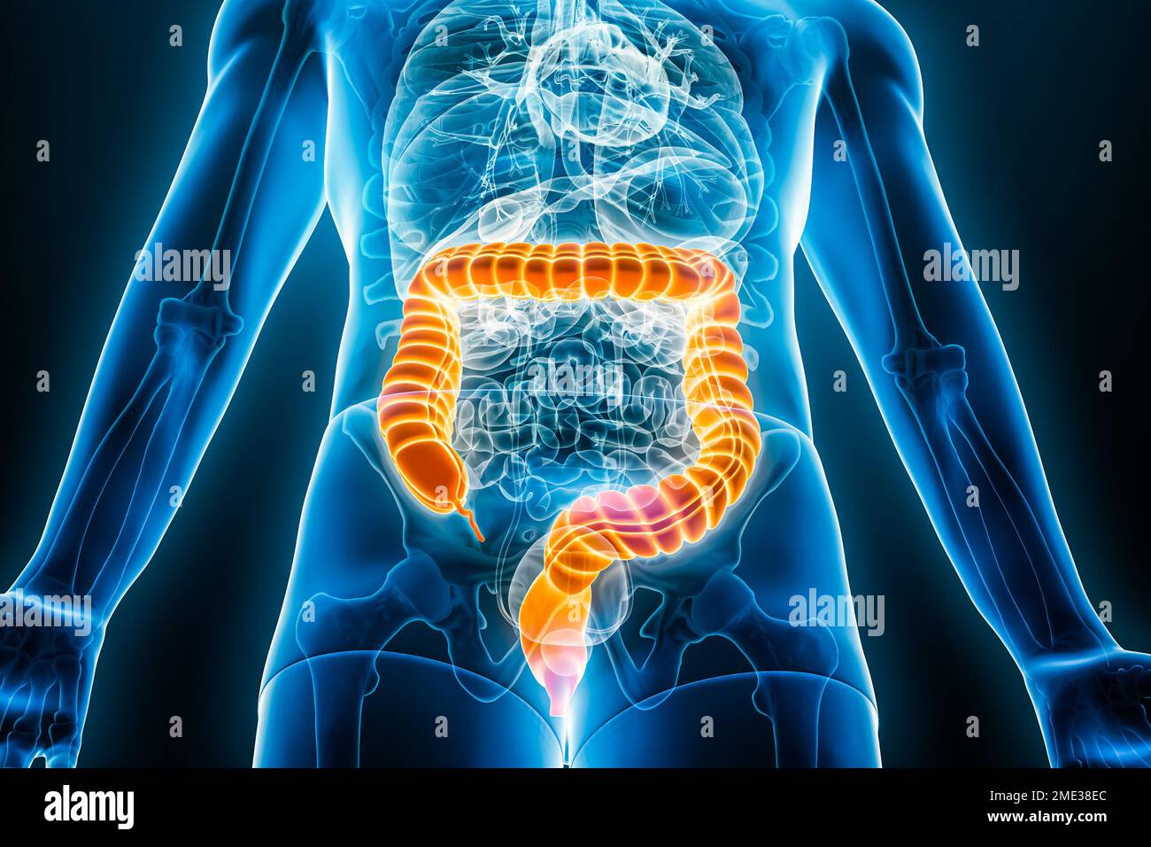 Vista anterior o frontal de rayos X del intestino grueso o colon 3D que representa la ilustración con contornos del cuerpo masculino. Anatomía humana, intestinos, médico, biología, sc Foto de stock