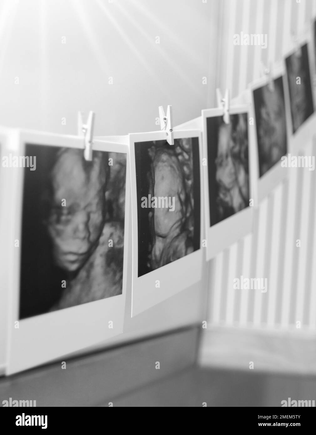 Embarazo/maternidad ultrasonido y álbum de fotos/recuerdo