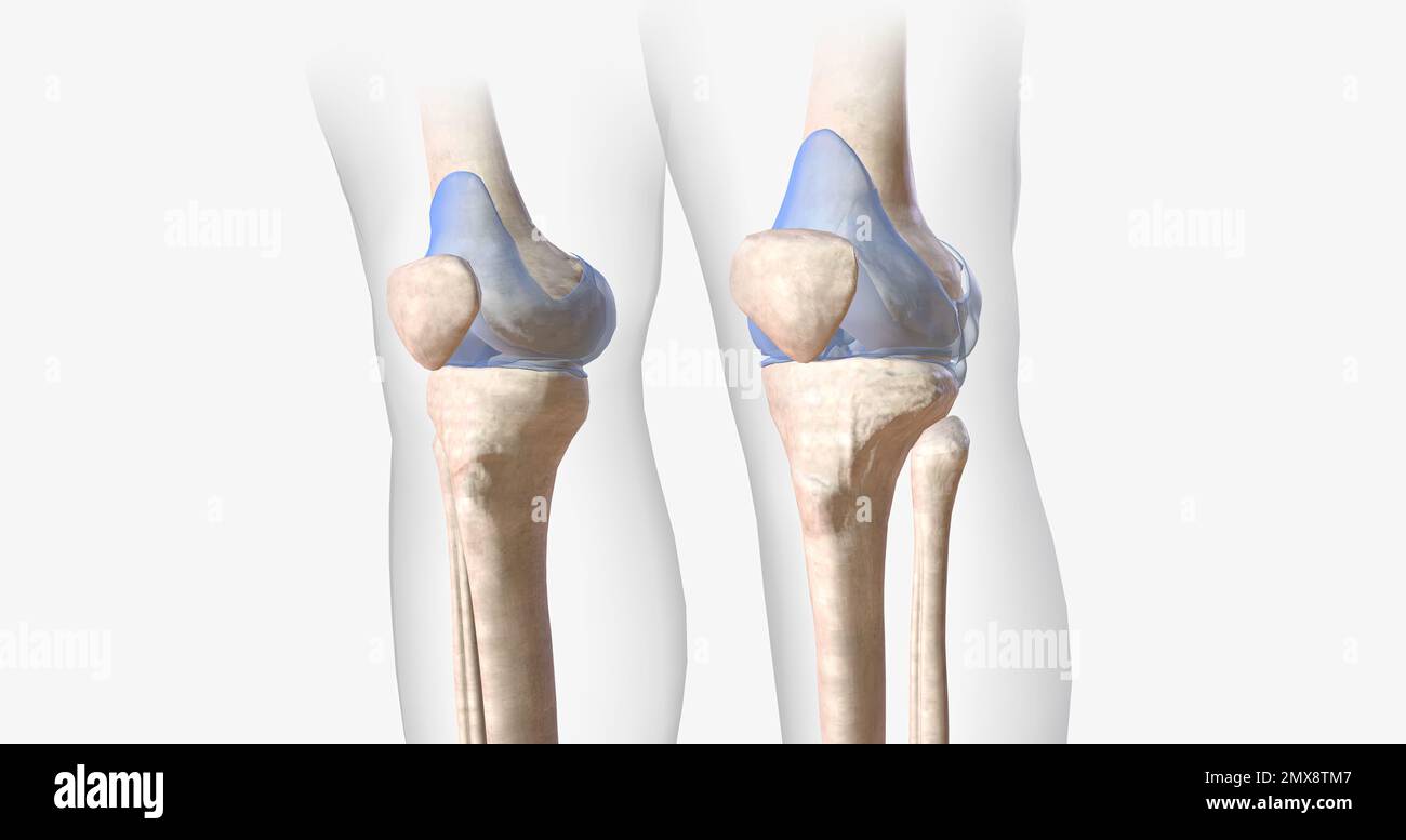 La articulación de la rodilla contiene ligamentos, membranas, bursas y