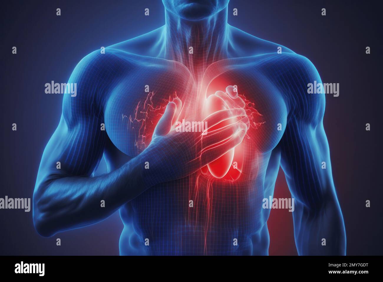 Una ilustración de ataque cardíaco es una representación visual de los síntomas, causas y efectos de un ataque cardíaco. Puede ser un dibujo, una pintura o un dígito Foto de stock