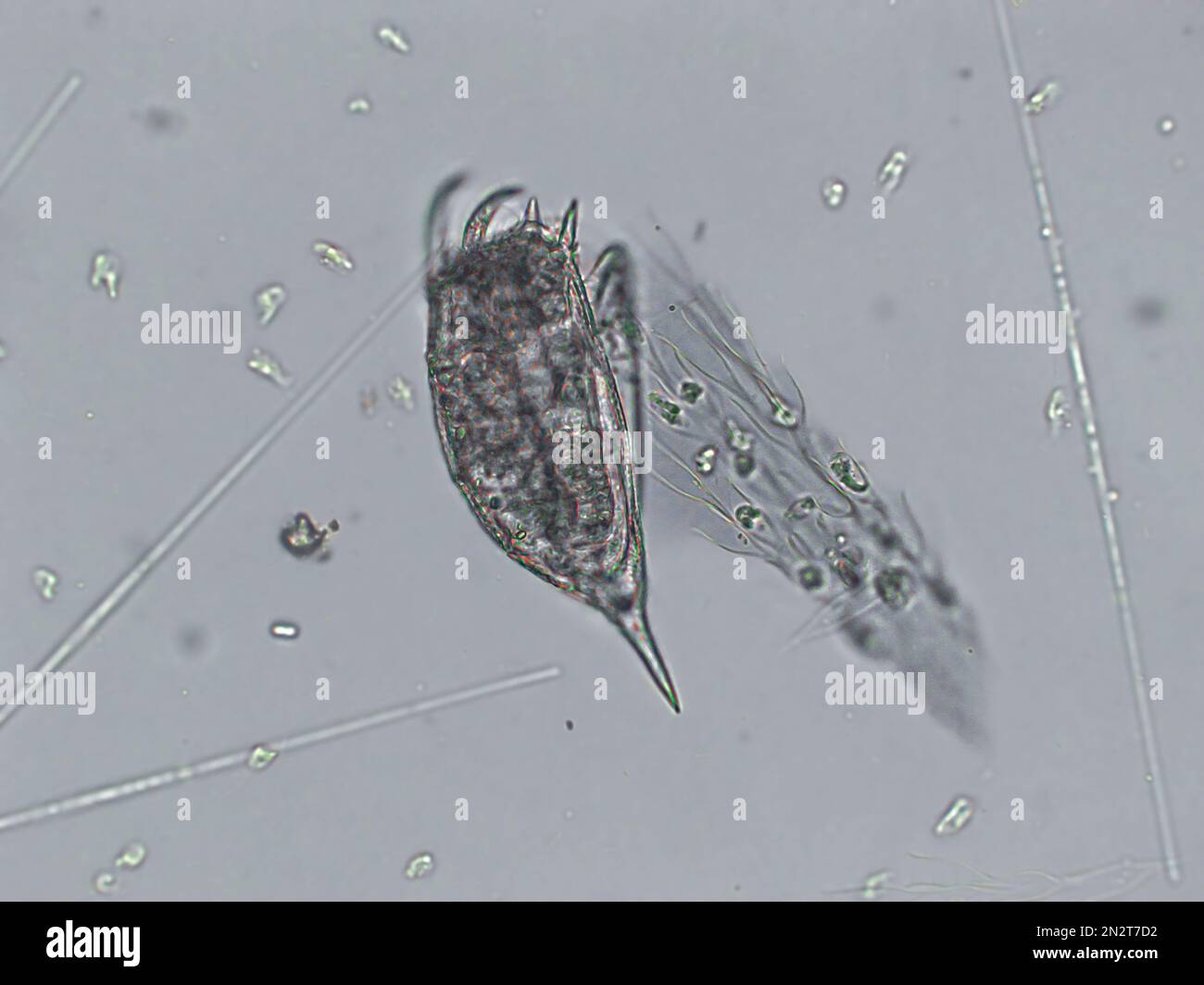 Zooplancton acuático de agua dulce y algas bajo vista microscópica Foto de stock