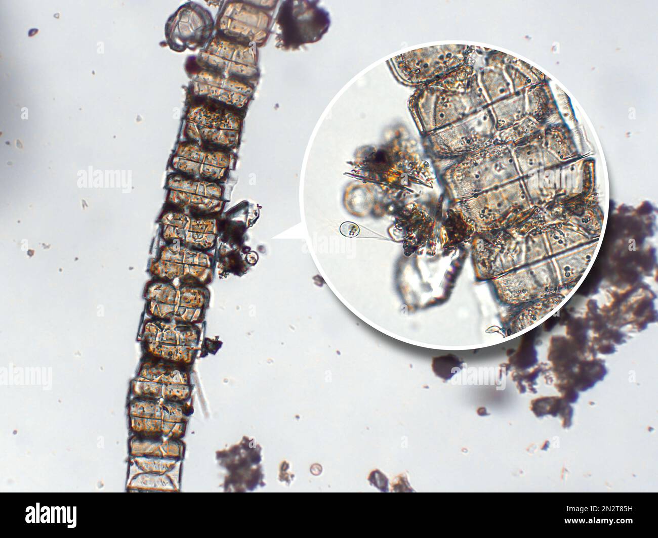 Zooplancton acuático de agua dulce y algas bajo vista microscópica Foto de stock