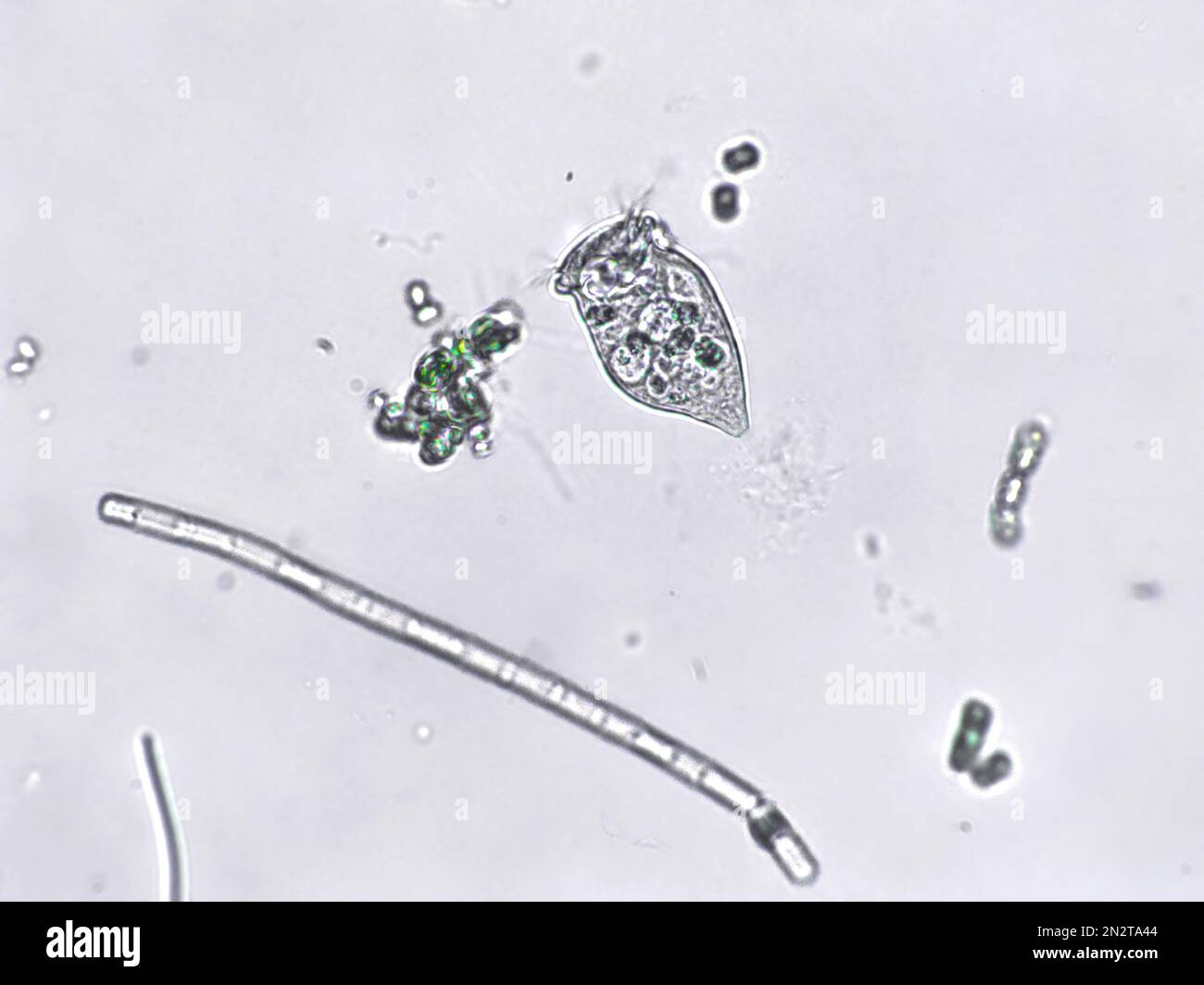 Zooplancton acuático de agua dulce y algas bajo vista microscópica Foto de stock