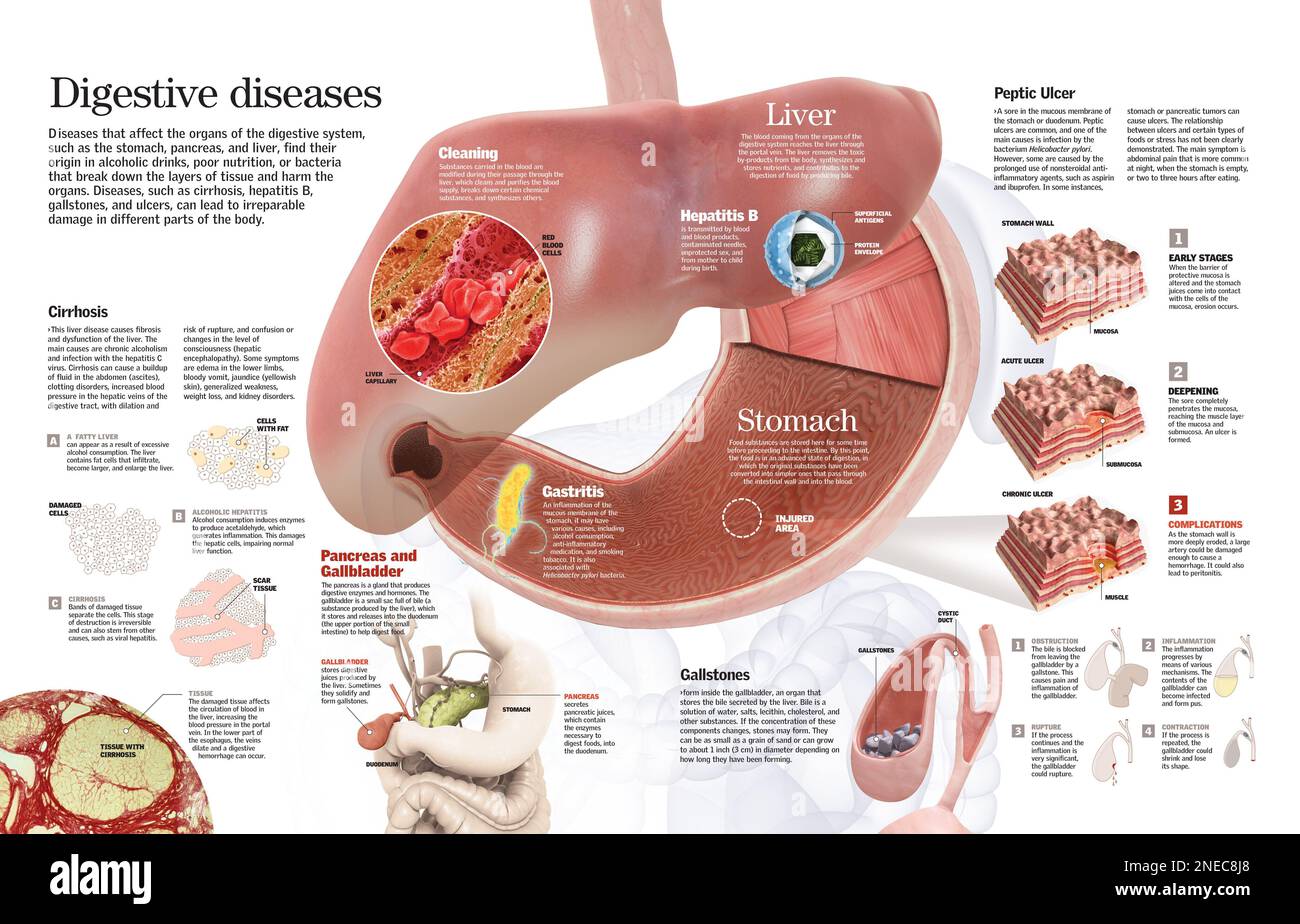 Infografía de las principales enfermedades que afectan a los órganos