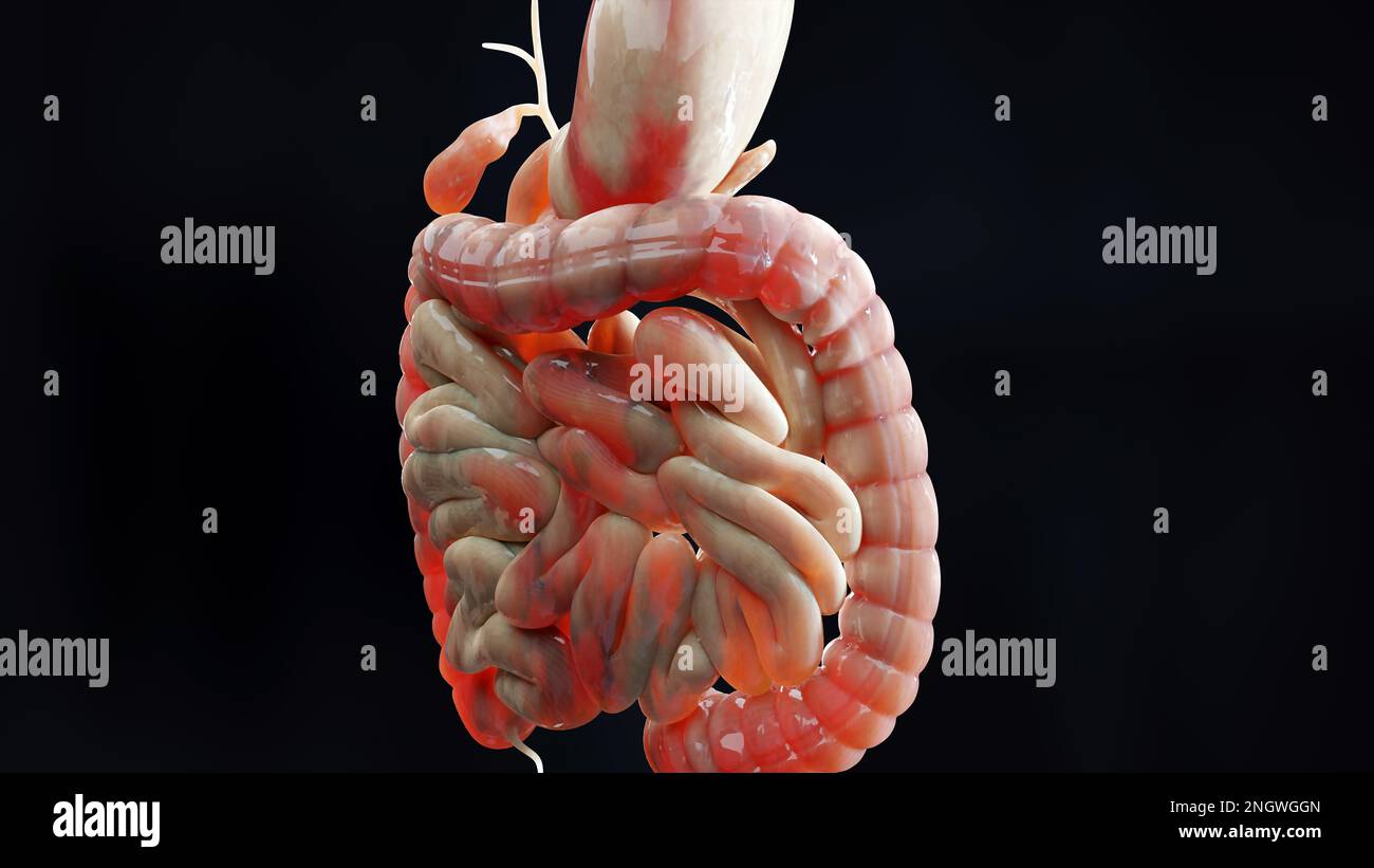 Hombre que sufre de la enfermedad de crohns, anatomía masculina, intestino grueso inflamado, colon sigmoide, partes del sistema digestivo humano, 3D render Foto de stock
