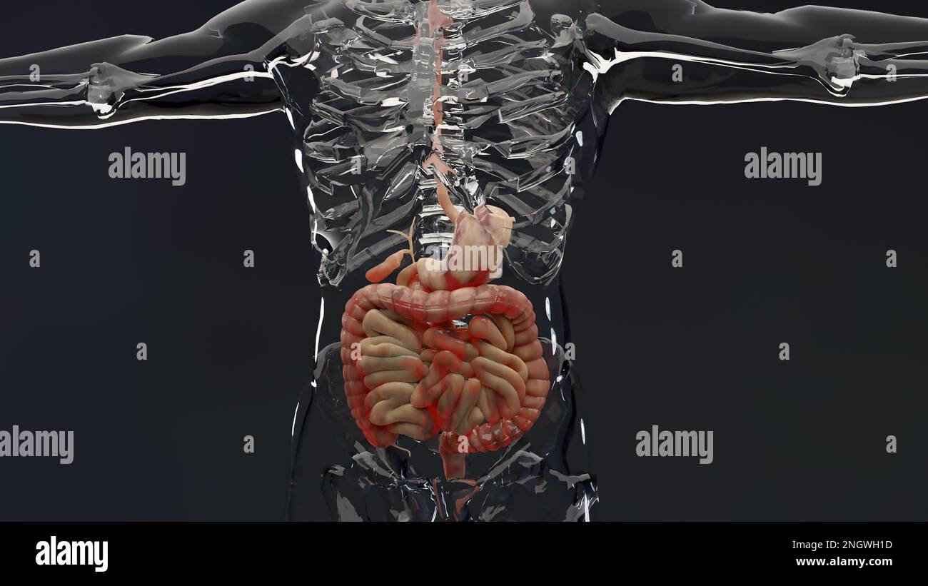 Hombre que sufre de la enfermedad de crohns, anatomía masculina, intestino grueso inflamado, colon sigmoide, partes del sistema digestivo humano, 3D render Foto de stock