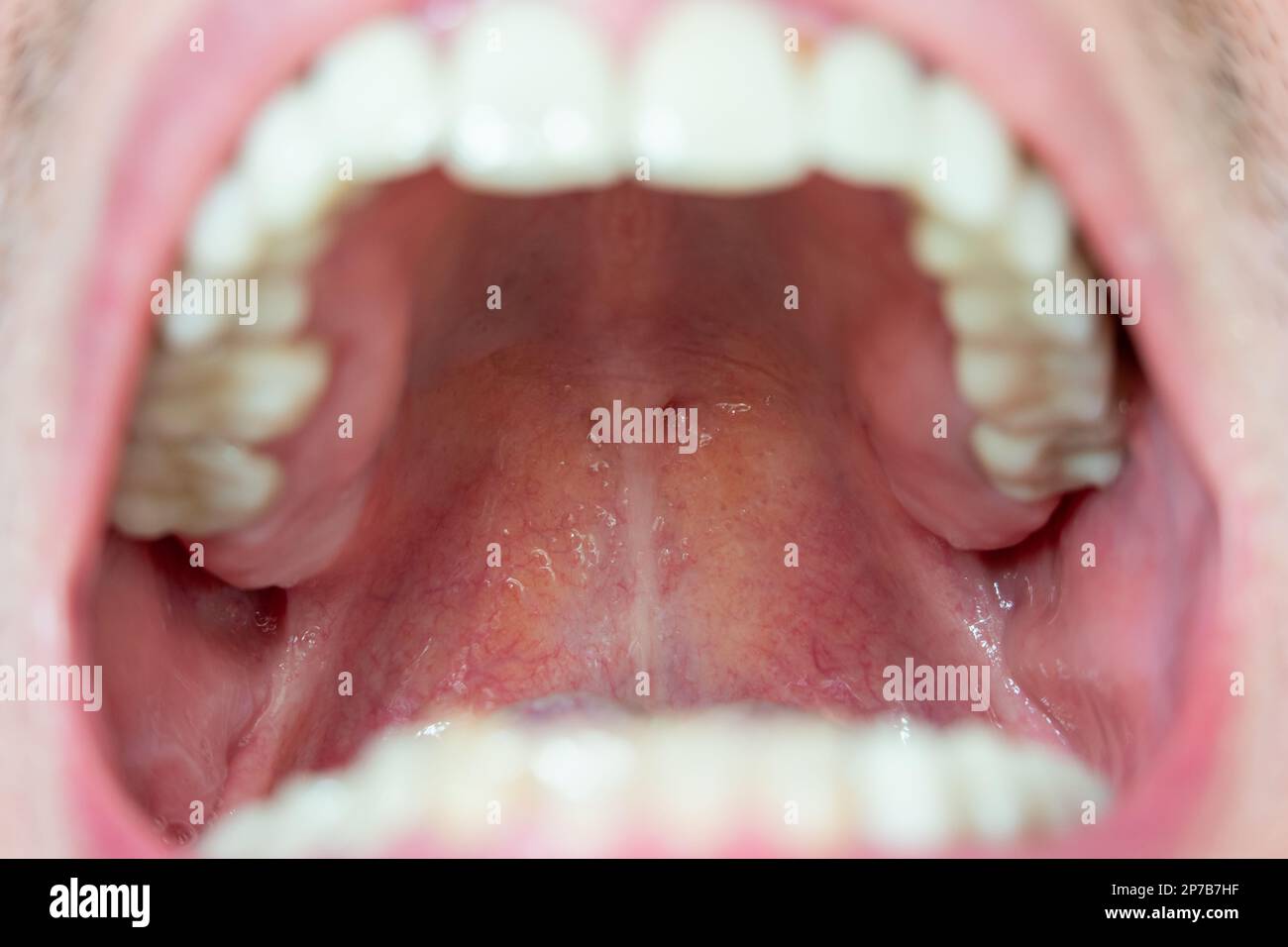 Parte posterior de la garganta, techo de la boca macro vista de cerca