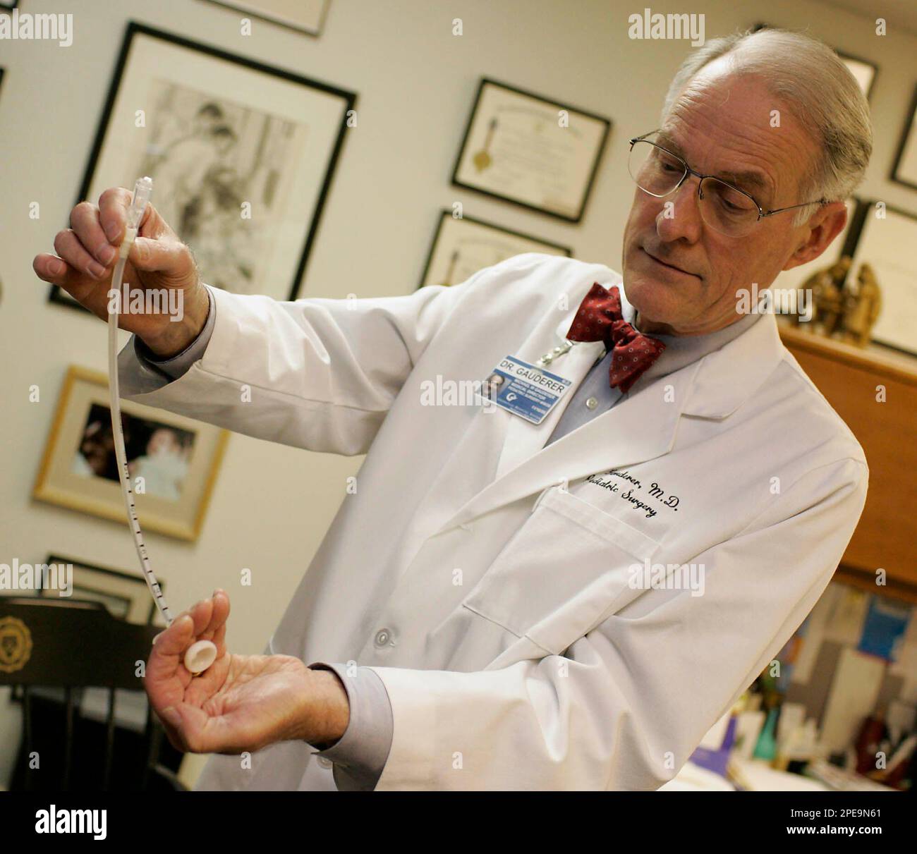 Michael W.L. Gauderer, M.D., FACS, FAAP, shows a Gastrostomy Tube