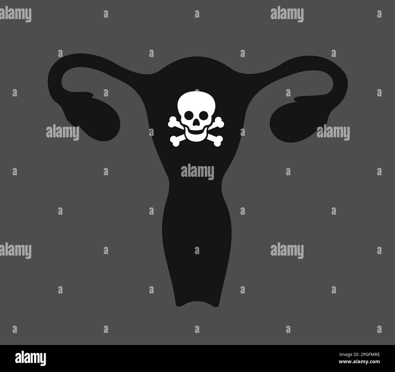 Útero y matriz con símbolo de cráneo y huesos cruzados - infertilidad y órgano femenino estéril estéril reproductivo estéril infértil. Aborto y aborto espontáneo. VEC Foto de stock