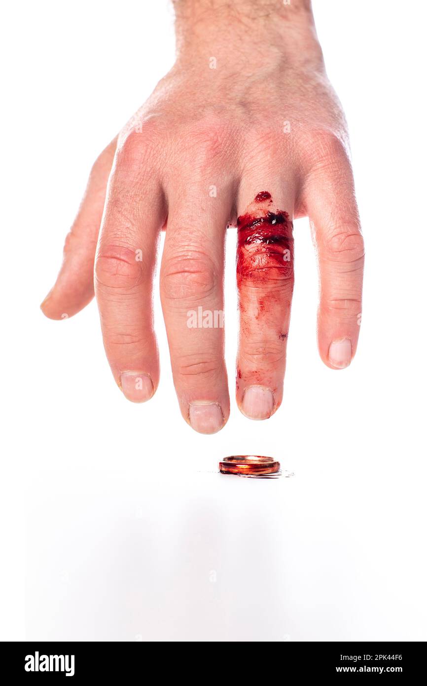 Mano con el dedo sangriento y el anillo de bodas sobre fondo blanco Foto de stock