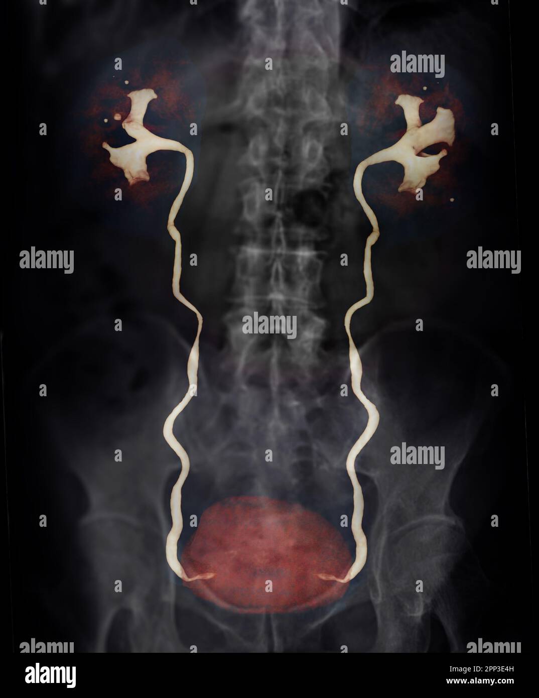 Anatomía Del Riñón, Uréter Y Vejiga