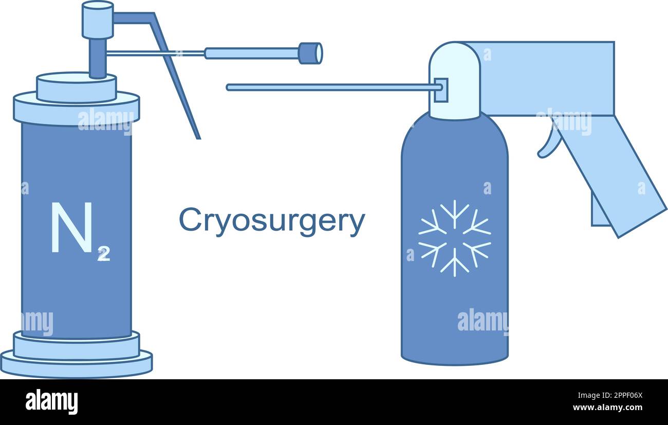 Instrumentos criogénicos para la ilustración de línea vectorial de  criocirugía. Refrigeración de nitrógeno líquido para tratamiento  criogénico. Terapia con hielo para lesiones benignas y malignas Imagen  Vector de stock - Alamy