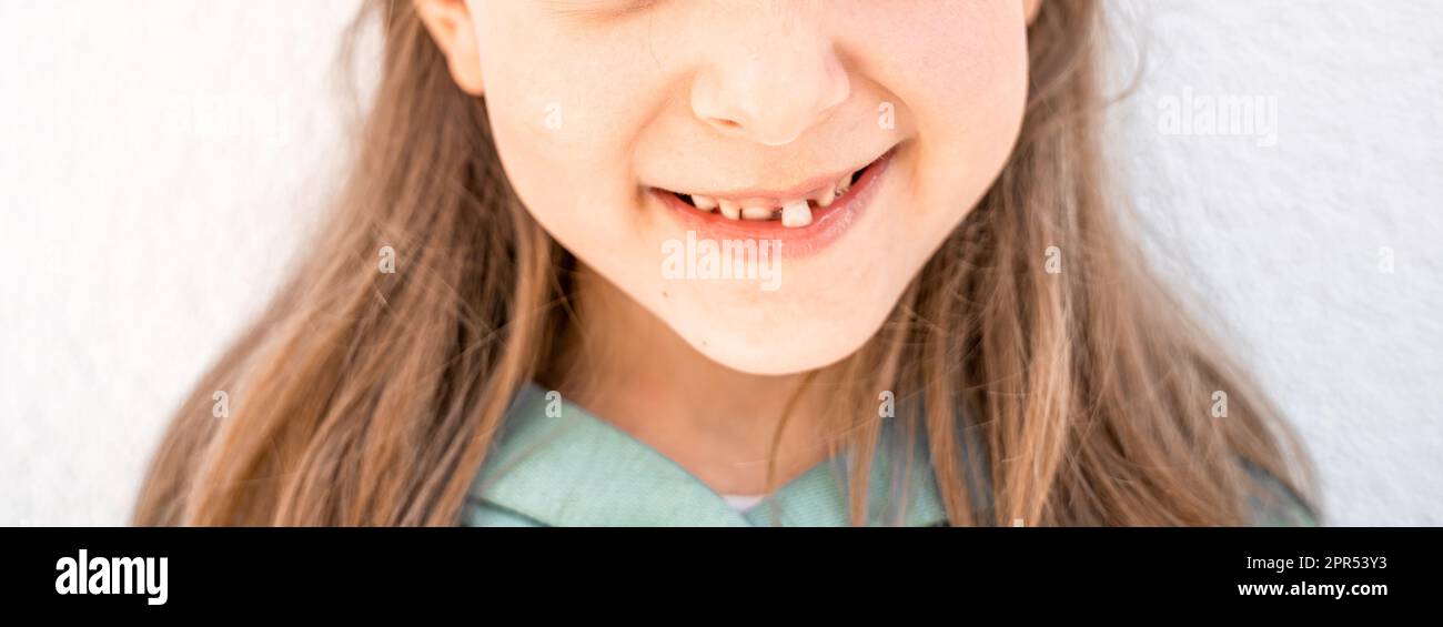 Niño sonriente encantador de la niña con la boca abierta muestra tambaleante suelta cayendo hacia fuera primer diente delantero de la leche del bebé. Dientes preescolares cambiando. Saludable Foto de stock