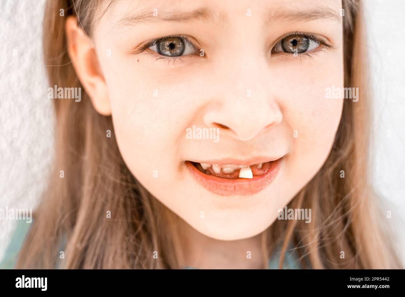 Niño sonriente encantador de la niña con la boca abierta muestra tambaleante suelta cayendo hacia fuera primer diente delantero de la leche del bebé. Dientes preescolares cambiando. Saludable Foto de stock