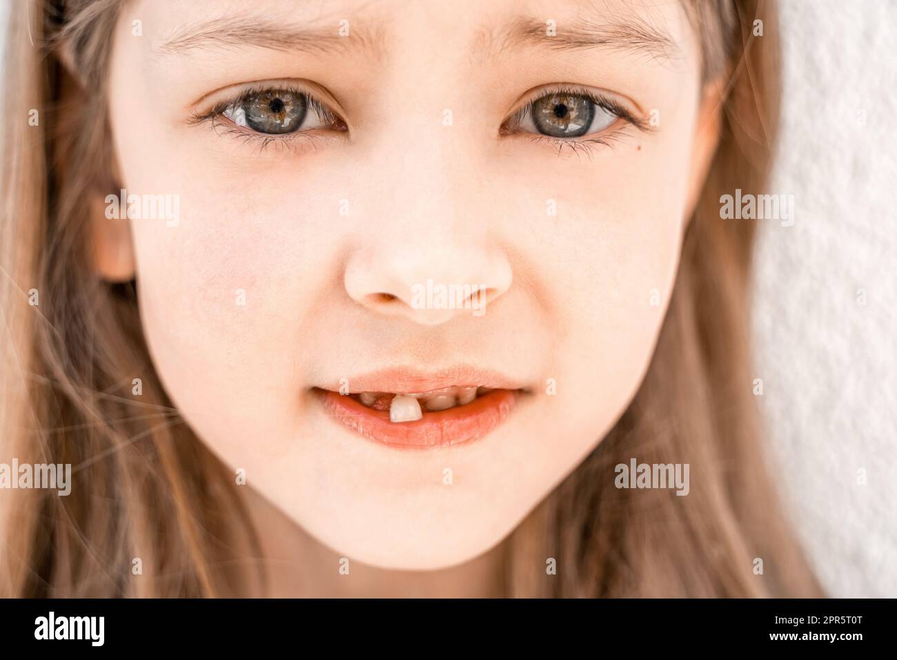 Niño sonriente encantador de la niña con la boca abierta muestra tambaleante suelta cayendo hacia fuera primer diente delantero de la leche del bebé. Dientes preescolares cambiando. Saludable Foto de stock