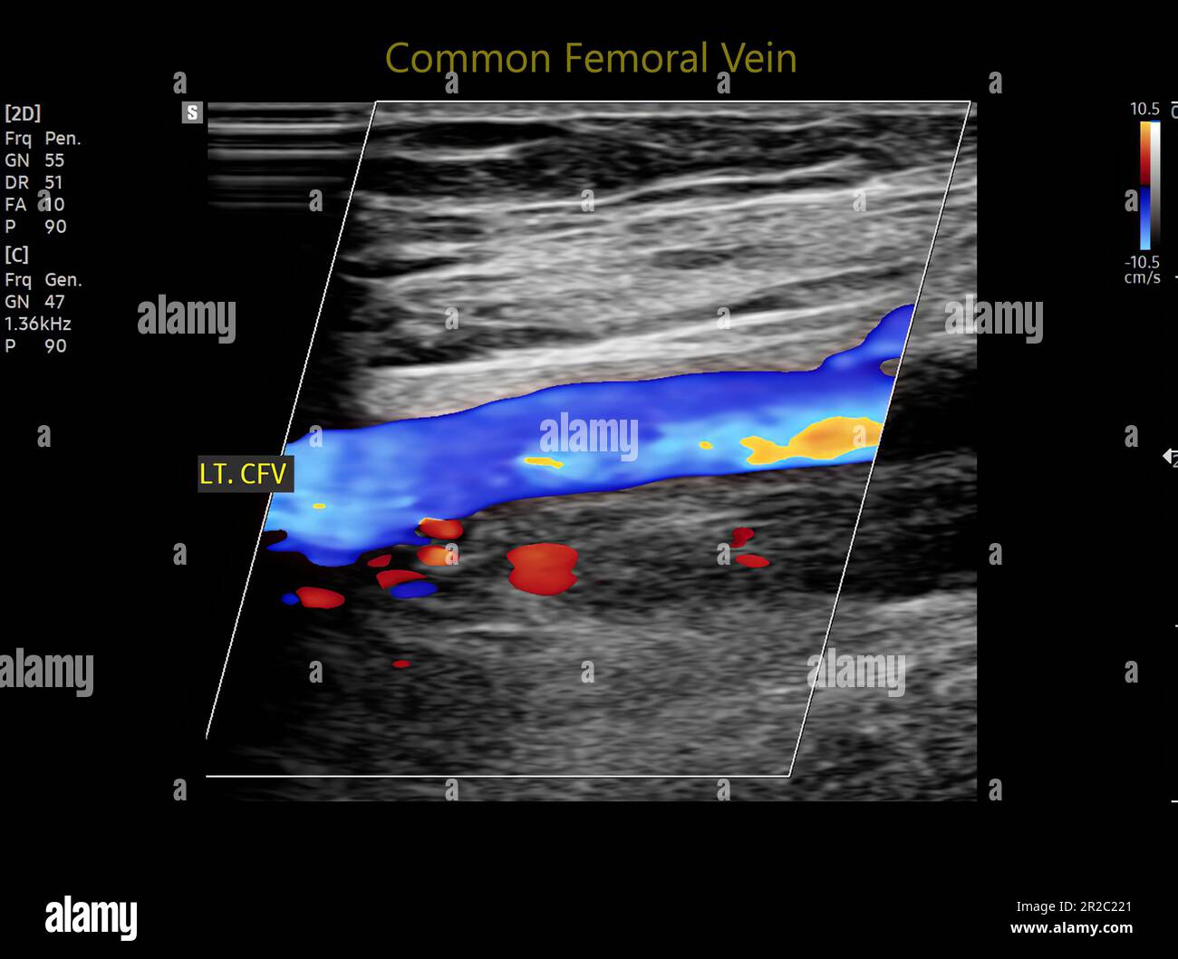 Doppler Fetal para escuchar los latidos del corazón de una mujer embarazada  de un niño y una imagen de una ecografía del embarazo, primer plano, fondo  de color rosa, pregnan Fotografía de