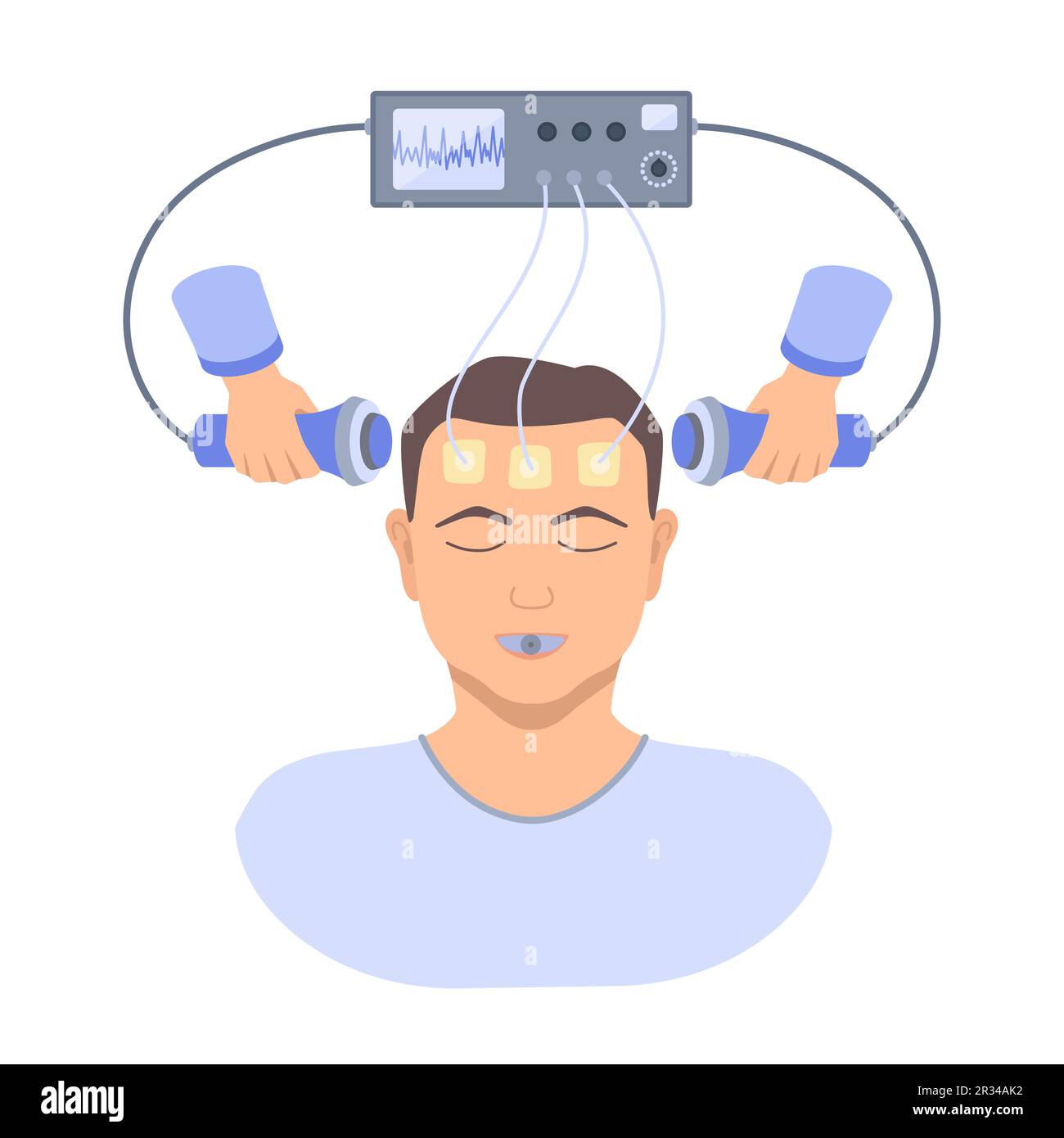 Terapia electroconvulsiva ECT para el tratamiento de la depresión severa Imagen Vector de stock Terapia electroconvulsiva ECT para el tratamiento de la depresión severa Imagen Vector de stock