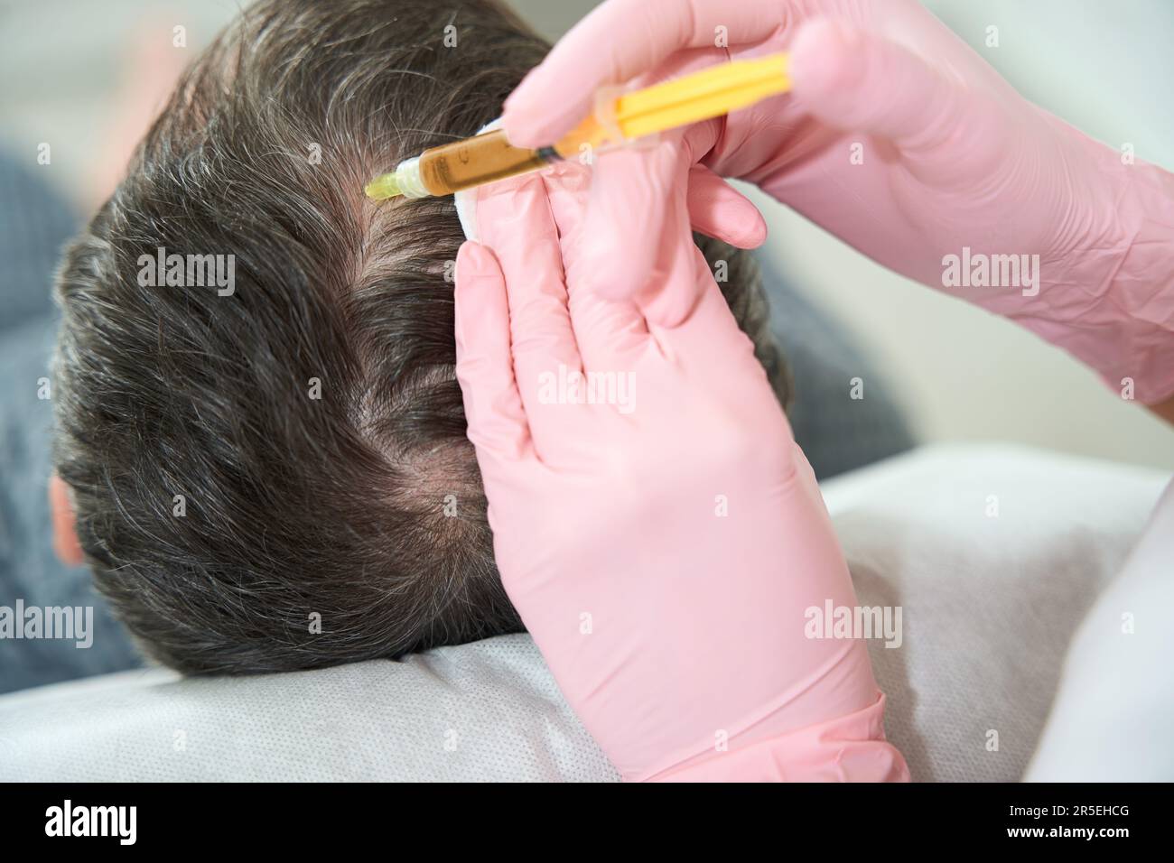 El especialista realiza el procedimiento de plasmolifting en el cuero  cabelludo Fotografía de stock - Alamy