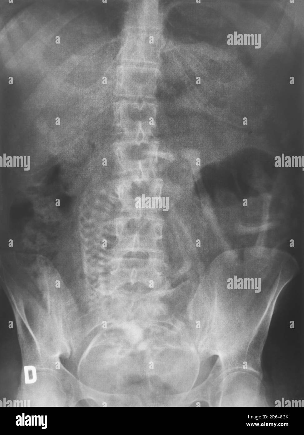 Radiografías del embarazo con el feto. Tecnología de diagnóstico