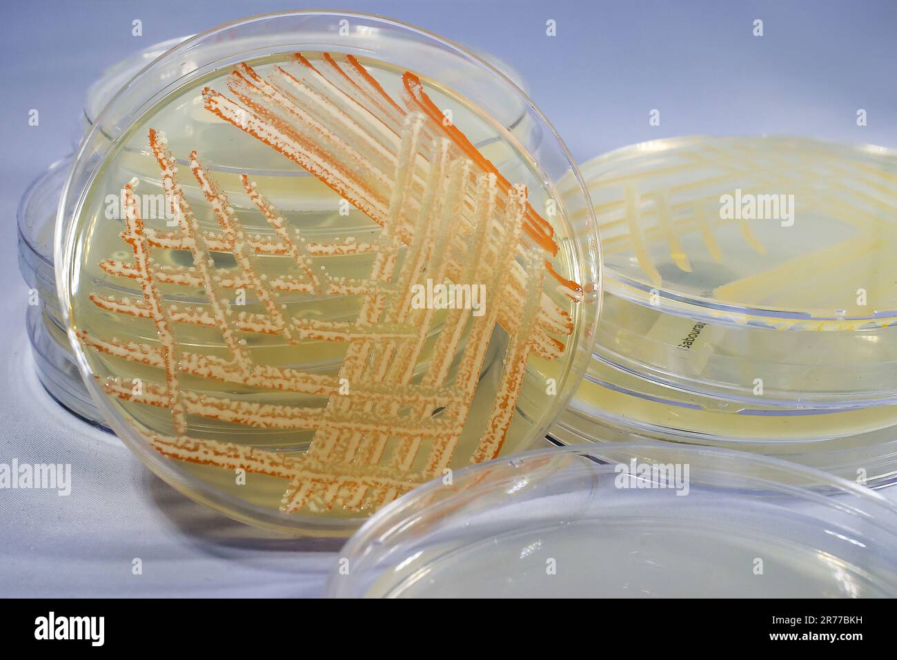 Cultivo mixto de bacterias de diferentes colores cultivadas en placa de  Petri con medio nutritivo, vista de primer plano Fotografía de stock - Alamy