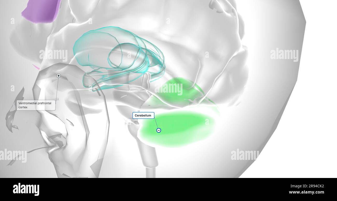 Se ha demostrado que este volumen reducido de la corteza prefrontal